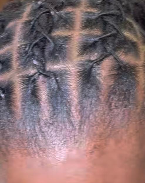 Freshly retwisted loc roots